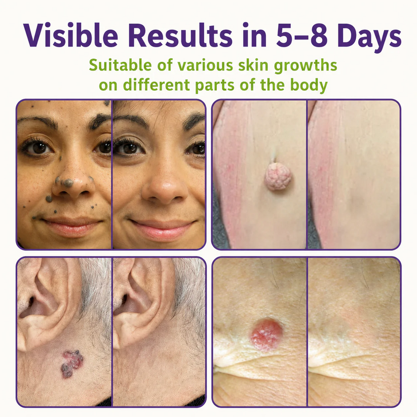 Various skin growths on different parts of the body
